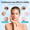Mascara Facial LED Inalambrica de Fototerapia