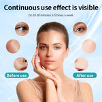 Mascara Facial LED Inalambrica de Fototerapia