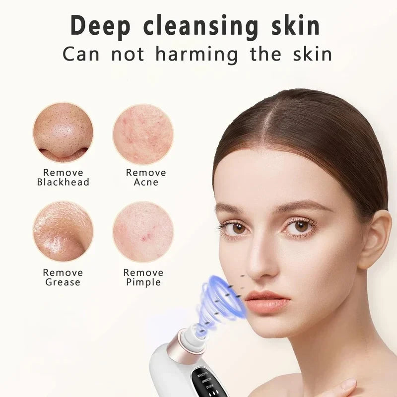 Water Cycle Blackhead Remover Pore Vacuum